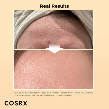 COSRX Snail Mucin 96% Power Face Serum 3.38 fl oz 100ml, Hydrating Serum for Face, Self Care, Glow Skin under Makeup, Korean Skin Care, Korean Beauty