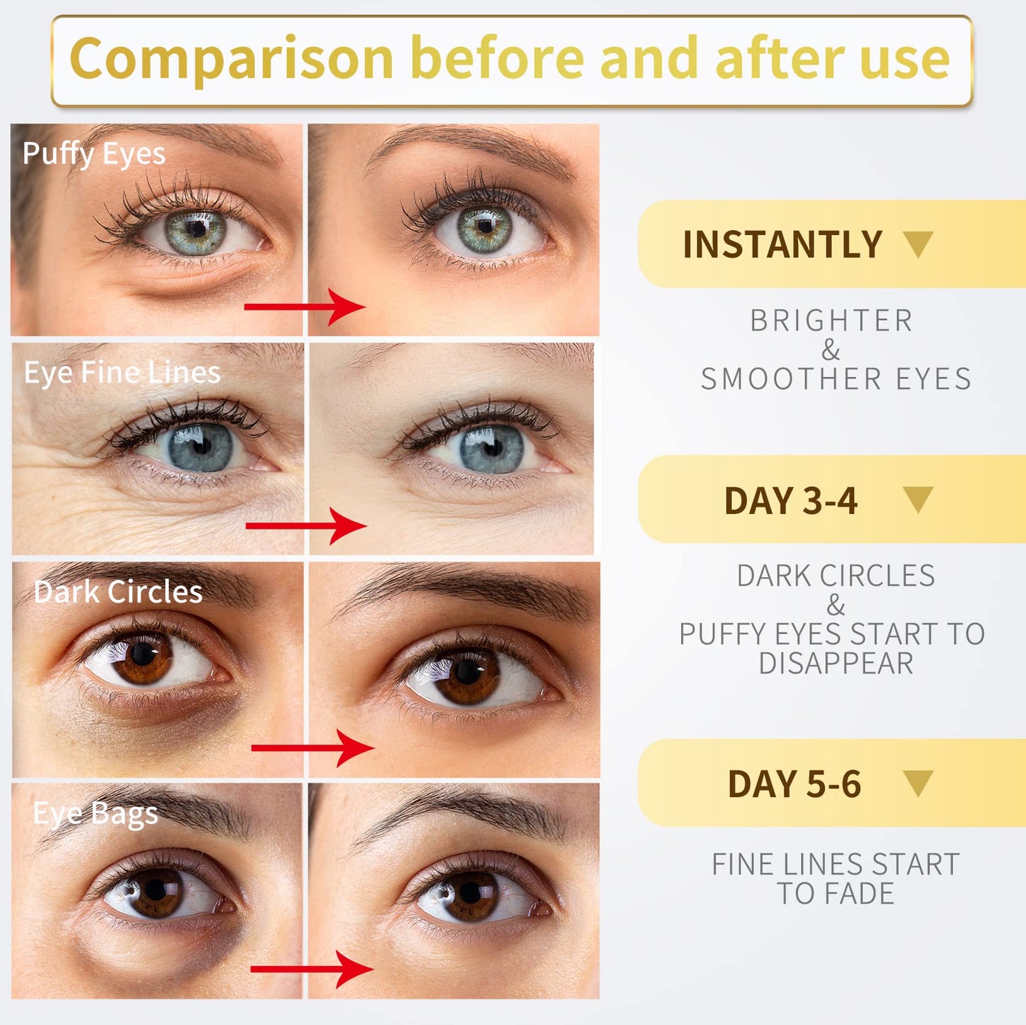 24K Gold Under Eye Patches - 60 Pack for Puffy Eyes, Dark Circles, Bags & Wrinkles with Collagen & Hyaluronic Acid - Eye Care Pads for Daily Skincare (Gold)