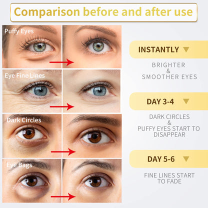 24K Gold Under Eye Patches - 60 Pack for Puffy Eyes, Dark Circles, Bags & Wrinkles with Collagen & Hyaluronic Acid - Eye Care Pads for Daily Skincare (Gold)